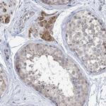 TTYH1 Antibody in Immunohistochemistry (IHC)