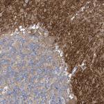 TTYH1 Antibody in Immunohistochemistry (IHC)