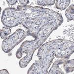 TTYH1 Antibody in Immunohistochemistry (IHC)