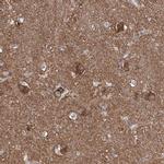 ZNF653 Antibody in Immunohistochemistry (IHC)