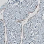 FBF1 Antibody in Immunohistochemistry (IHC)