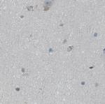 FBF1 Antibody in Immunohistochemistry (IHC)