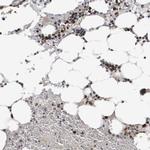 CDCA5 Antibody in Immunohistochemistry (IHC)