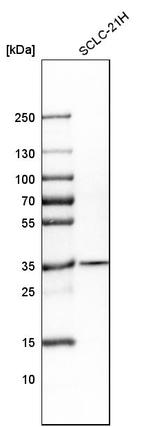 CDCA5 Antibody in Western Blot (WB)