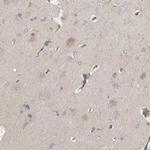 C9orf72 Antibody in Immunohistochemistry (IHC)