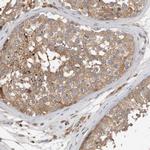 C9orf72 Antibody in Immunohistochemistry (IHC)