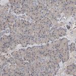 C9orf72 Antibody in Immunohistochemistry (IHC)