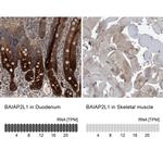 BAIAP2L1 Antibody