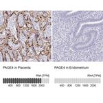 PAGE4 Antibody in Immunohistochemistry (IHC)