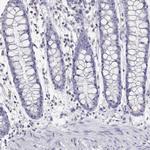 Adenosine Deaminase Antibody in Immunohistochemistry (IHC)