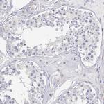 Adenosine Deaminase Antibody in Immunohistochemistry (IHC)