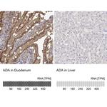 Adenosine Deaminase Antibody