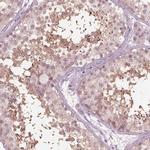 FAM154A Antibody in Immunohistochemistry (IHC)