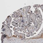 STC1 Antibody in Immunohistochemistry (IHC)