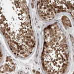 XPO5 Antibody in Immunohistochemistry (IHC)