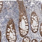 WIPF2 Antibody in Immunohistochemistry (IHC)