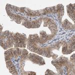 WIPF2 Antibody in Immunohistochemistry (IHC)