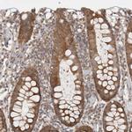 WIPF2 Antibody in Immunohistochemistry (IHC)