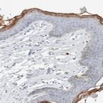 ALOX12B Antibody in Immunohistochemistry (IHC)