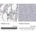 HPGDS Antibody