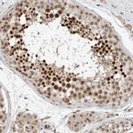 ZFP91 Antibody in Immunohistochemistry (IHC)