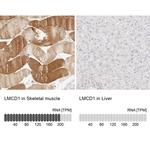 LMCD1 Antibody