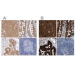 GDA Antibody in Immunohistochemistry (IHC)