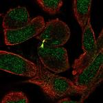 SETX Antibody in Immunocytochemistry (ICC/IF)