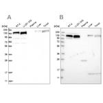 ERC1 Antibody in Western Blot (WB)