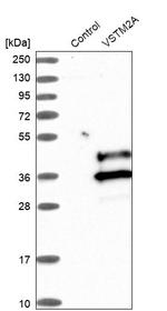 VSTM2A Antibody in Western Blot (WB)