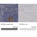 KIF18B Antibody