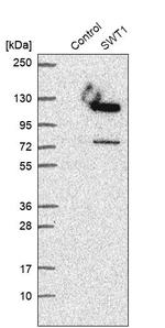 C1orf26 Antibody in Western Blot (WB)