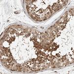 Synip Antibody in Immunohistochemistry (IHC)