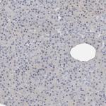 DNAJB6 Antibody in Immunohistochemistry (IHC)