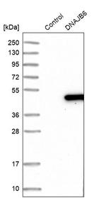 DNAJB6 Antibody in Western Blot (WB)