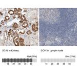 SCIN Antibody in Immunohistochemistry (IHC)