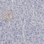 B3GNT3 Antibody in Immunohistochemistry (IHC)