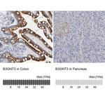 B3GNT3 Antibody