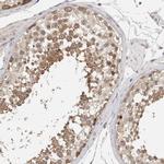 Lass3 Antibody in Immunohistochemistry (IHC)