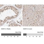 GCN1L1 Antibody in Immunohistochemistry (IHC)