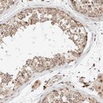 GCN1L1 Antibody in Immunohistochemistry (IHC)