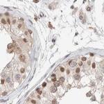 GATAD2A Antibody in Immunohistochemistry (IHC)