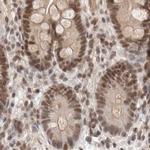 GATAD2A Antibody in Immunohistochemistry (IHC)