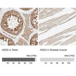 ADSS Antibody in Immunohistochemistry (IHC)