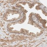 ADSS Antibody in Immunohistochemistry (IHC)