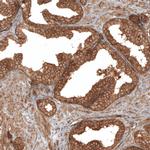 TAX1BP1 Antibody in Immunohistochemistry (IHC)