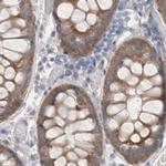 WIPF2 Antibody in Immunohistochemistry (IHC)