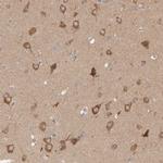 WIPF2 Antibody in Immunohistochemistry (IHC)