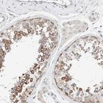 CASC3 Antibody in Immunohistochemistry (IHC)