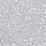 ADAM2 Antibody in Immunohistochemistry (IHC)